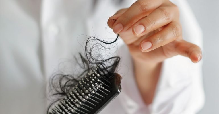 woman-losing-hair-on-hairbrush-in-hand-on-bathroom-royalty-free-image-1569427395